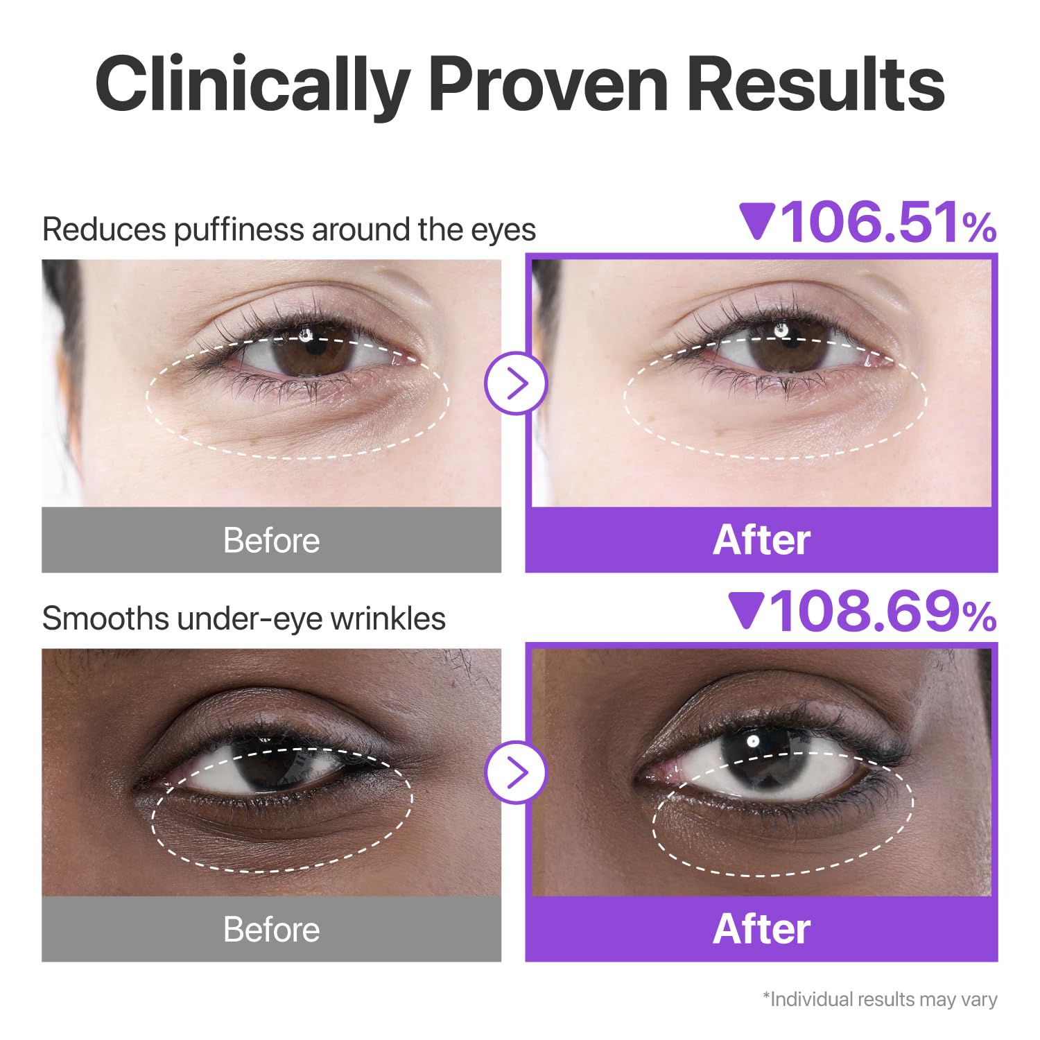[Numbuzin] No.9 NAD+ Collagen Under Eye Patches (5ea)