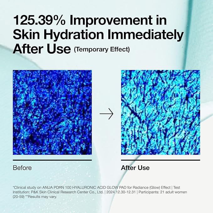 [Anua] PDRN 100 Hyaluronic Acid Glow Pad 6.08 fl oz (180ml) (60Pads)