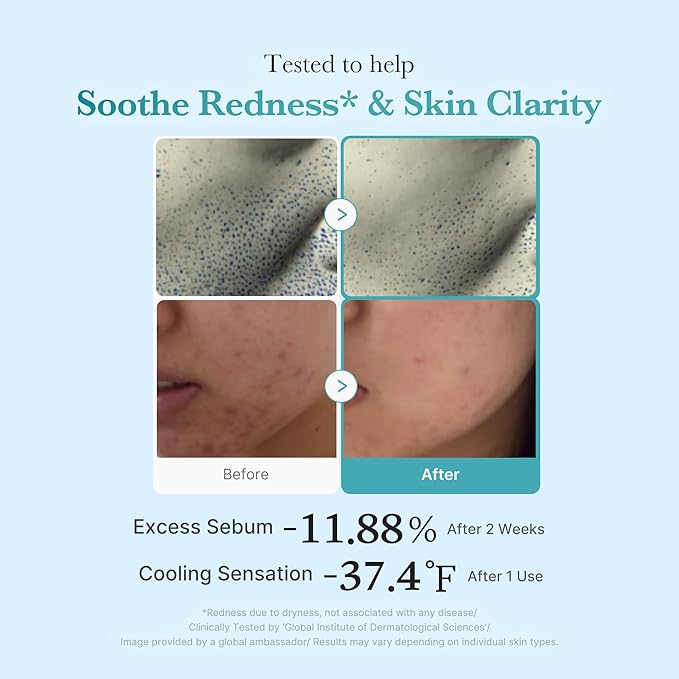 [Medicube] Azelaic Acid Niacinamide Clear Toner 8.45 fl oz (250ml)