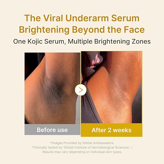 [Medicube] Kojic Acid Turmeric Niacinamide Serum 1.01 fl oz (30ml)