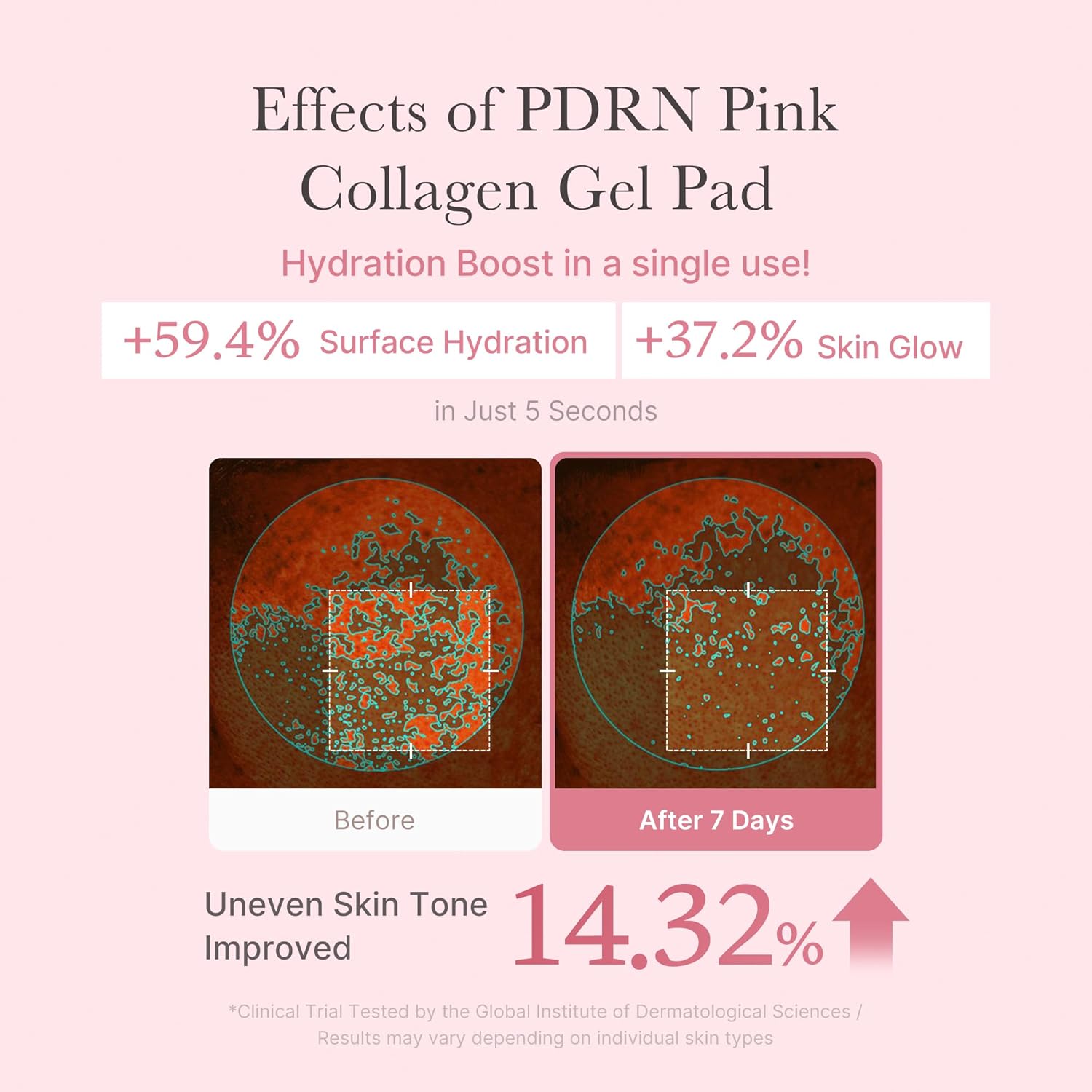 [Medicube] PDRN Pink Collagen Toning Gel Toner Pad 4.05 fl oz (120ml) (70Pads)
