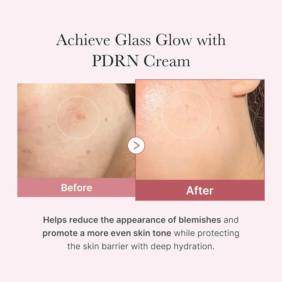 [Medicube] PDRN Pink Hyaluronic Moisturizing Cream 1.69 fl oz (50ml)