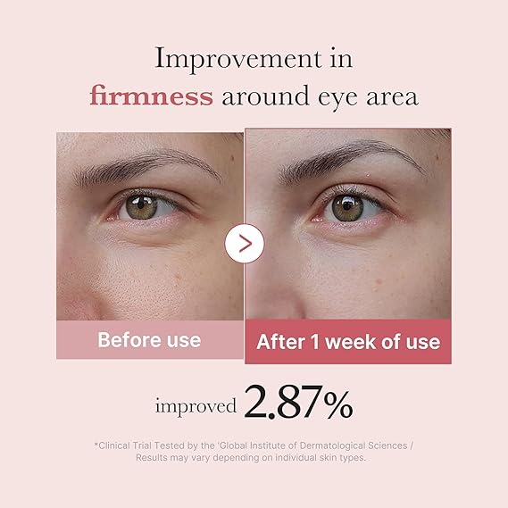 [Medicube] PDRN Pink Peptide Eye Cream 1.01 fl oz (30ml)