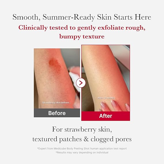 [Medicube] Red Acne Body Peeling Shot 3.88 oz (110g)