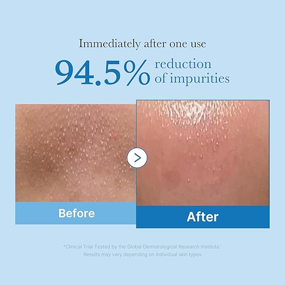 [Medicube] Zero Pore Blackhead Deep Cleansing Oil 6.93 fl oz (205ml)