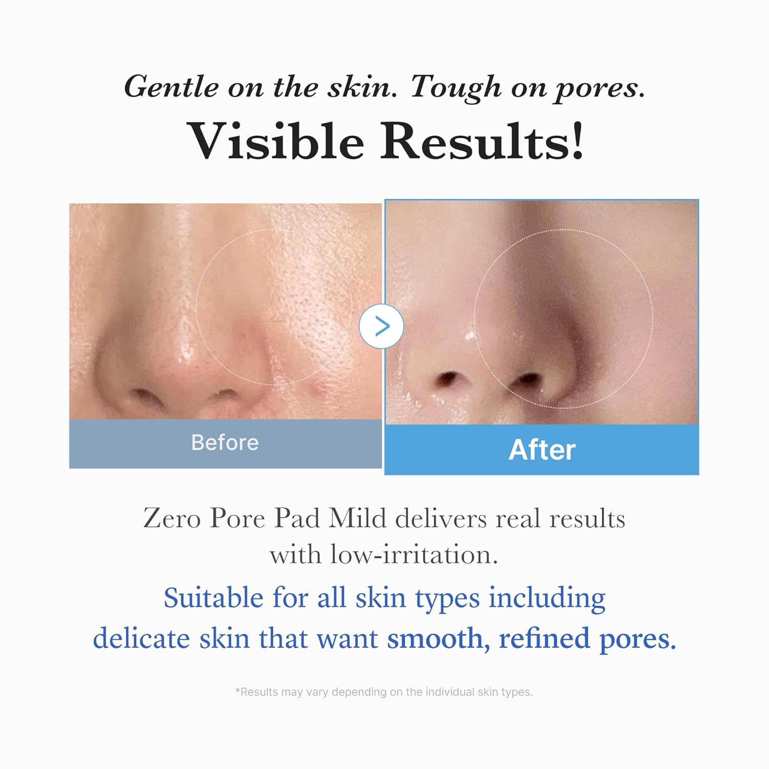 [Medicube] Zero Pore Pad Mild  5.46 oz (155g) (70Pads)