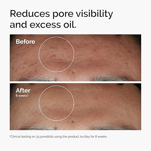 [The ordinary] Niacinamide 10% + Zinc 1% 2.02 fl oz (60ml)
