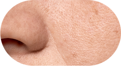 Large Pore Skin