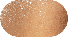 Oily Skin